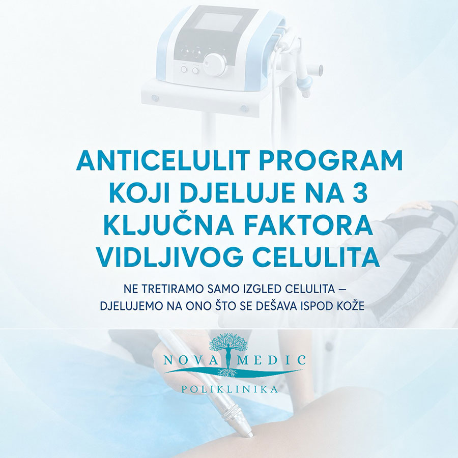 Anticelulit program